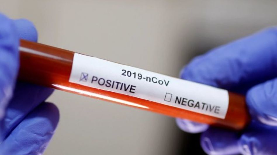 Confirmaron 88 nuevos casos de coronavirus y cinco muertes: hay 1.335 contagiados