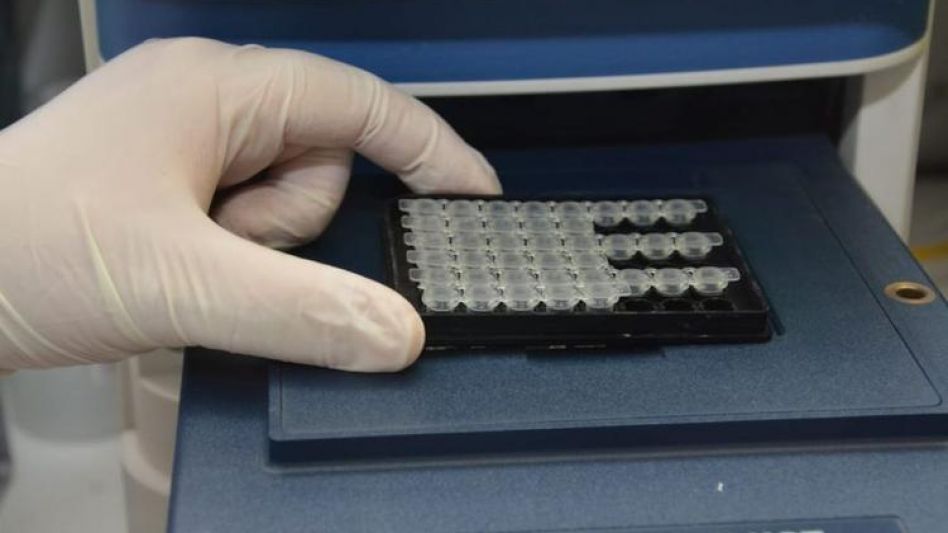 Los resultados de las muestras analizadas por el laboratorio del Argentina Diego tardan 24 horas en darse a conocer. Los primeros cinco testeos realizados dieron resultado negativo.