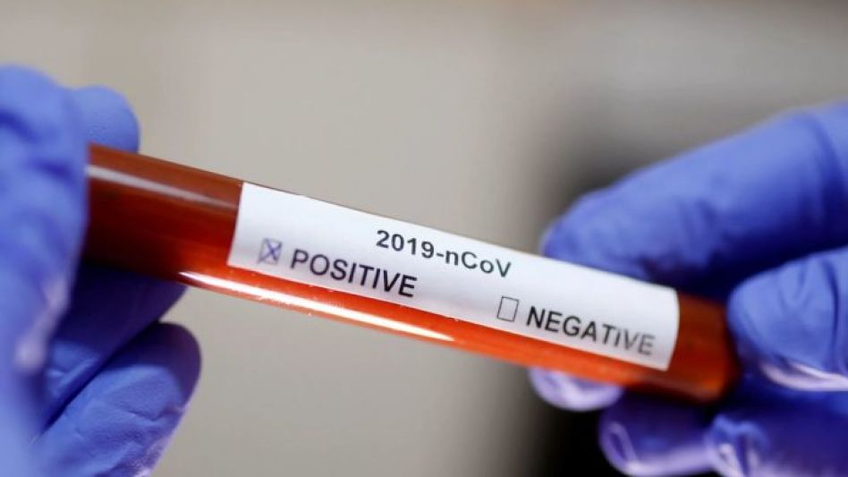 Coronavirus: 1451 positivos y 44 fallecidos