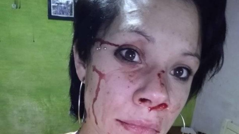 Su ex pareja publicó en redes sociales una foto suya, mostrando cómo había quedado su rostro luego de que fuera agredida nuevamente por el encausado. 