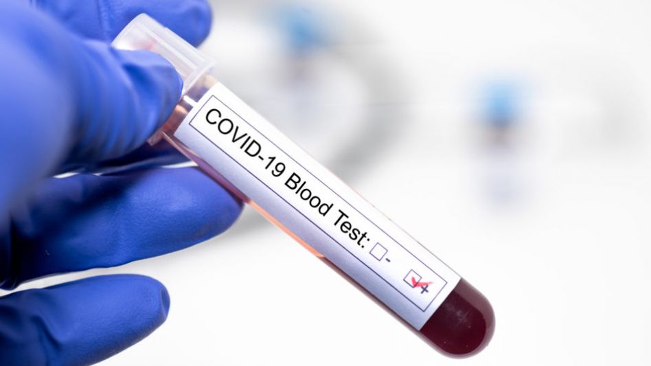 Coronavirus: Confirman nuevo récord de casos y ya hay 16.214 infectados