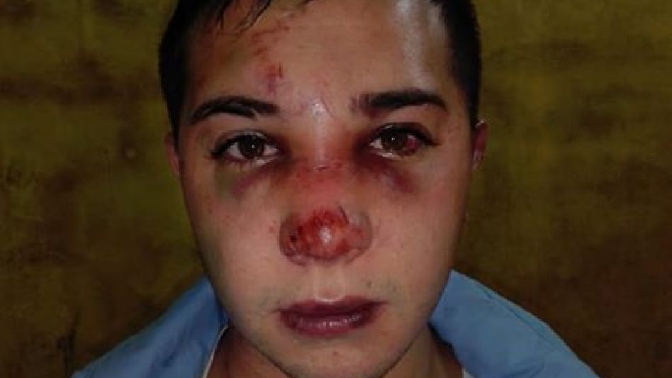 Una víctima de una brutal agresión y tres imputados, quienes fueron detenidos en allanamientos que se hicieron este domingo. Los acusan de un intento de homicidio. FOTOS: FACEBOOK Y DDI AZUL