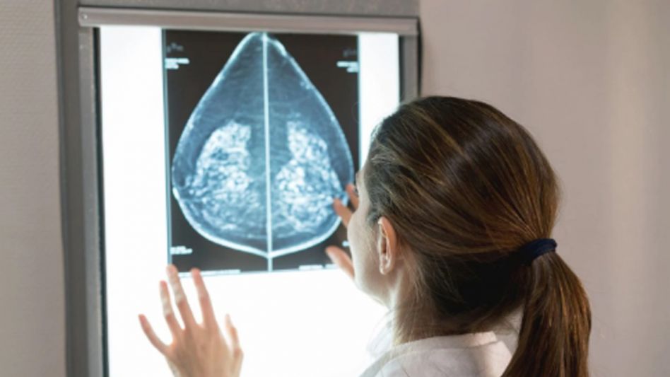 Cáncer de mama: cada año se diagnostican 21.000 nuevos casos