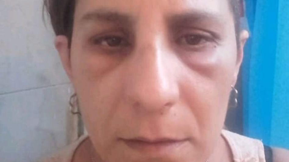  El estado en que había quedado su ex pareja después de una de las agresiones que sufriera. FOTOS: ARCHIVO/EL TIEMPO Y FACEBOOK