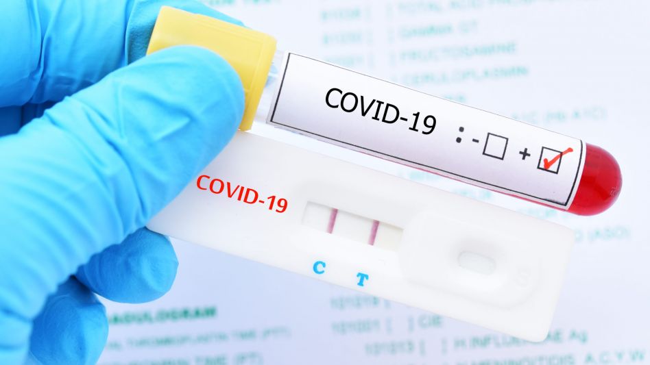 Hubo 11.057 contagios y 144 fallecidos por la pandemia según el último informe