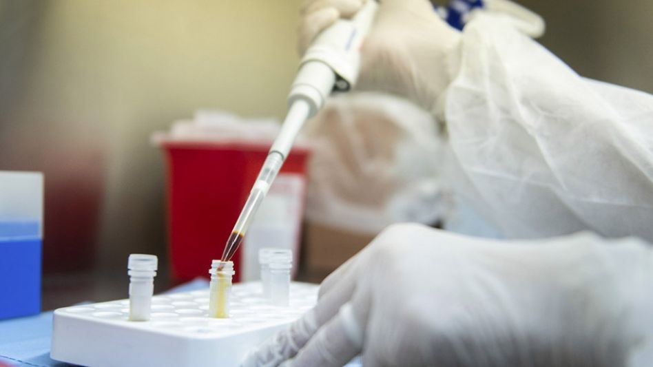 ¿Sirve medir anticuerpos después de vacunarse para evaluar la protección?