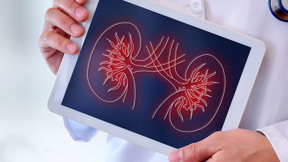 Cáncer de Riñón: advierten por serias demoras en la detección