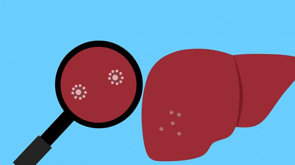 Se detectan 6 casos de cáncer de hígado por día en Argentina