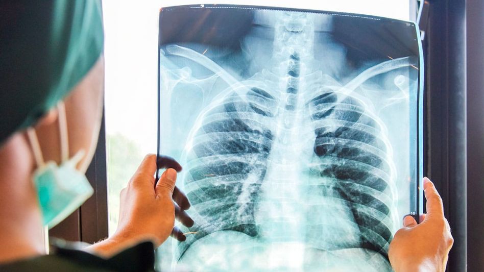 Pulmones sanos: claves para prevenir la enfermedad que altera la respiración