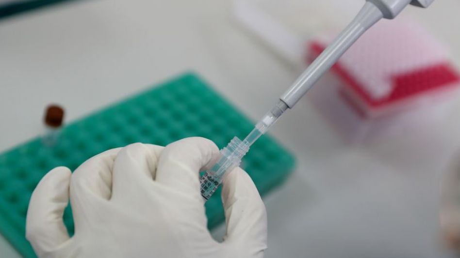 Coronavirus: repunte en los contagios al realizarse más testeos y otros 167 muertos en las últimas 24 horas