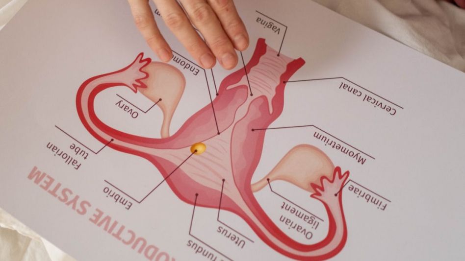 La principal causa de la enfermedad es el Virus del Papiloma Humano (VPH), que se transmite por contacto directo durante la actividad sexual.