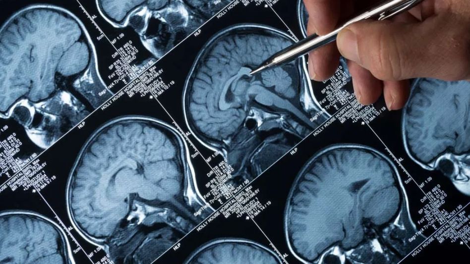 Estudio científico busca causas genéticas del Alzheimer y toma muestras en el AMBA