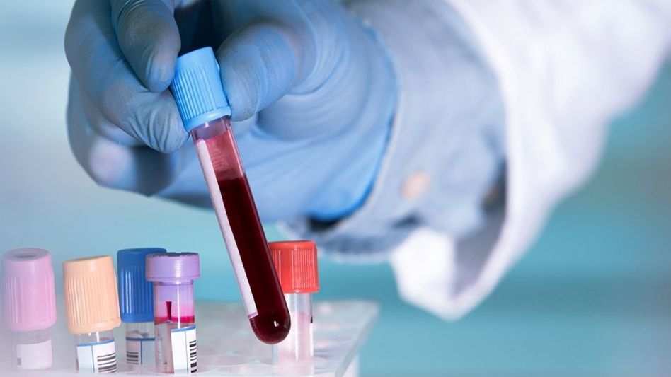 Un análisis de sangre permite detectar el cáncer de mama y de próstata en forma temprana