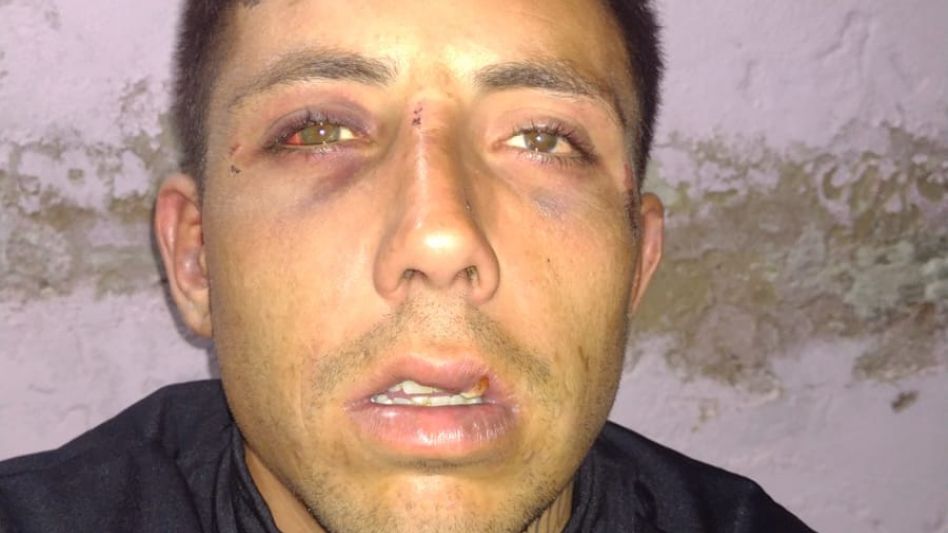 Una mujer denunció que a  su hijo lo golpeó un policía