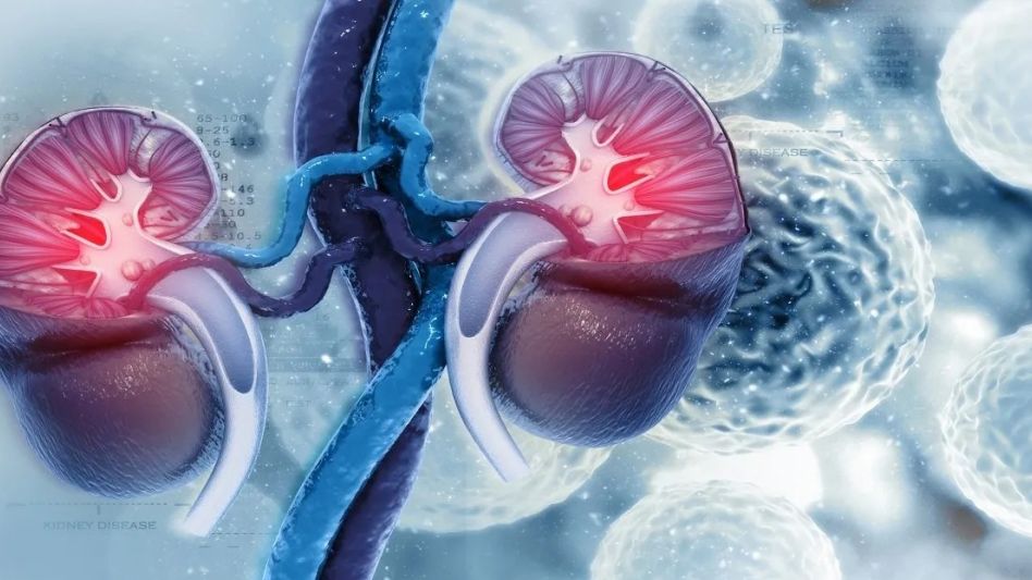 Cáncer de riñón: cada año hay casi 5.000 nuevos diagnósticos