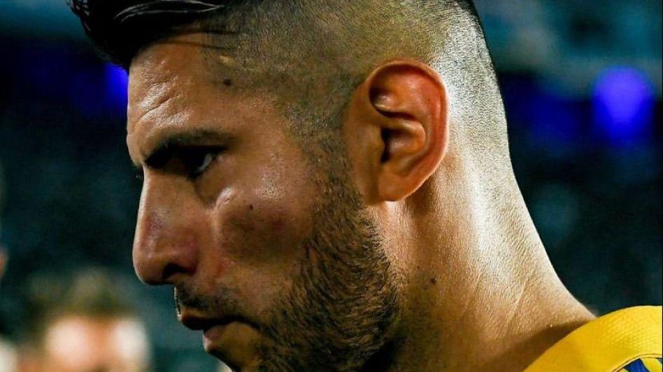 Cuando el equipo volvió a la cancha para disputar el segundo período, el peruano presentaba marcas en el rostro. Foto: Internet.