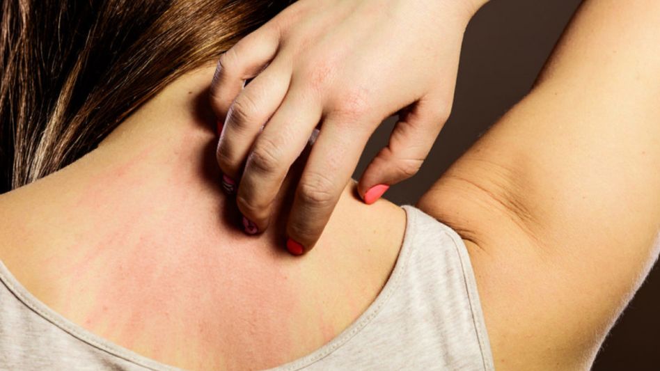 Impacto psicológico: las consecuencias emocionales de la dermatitis atópica