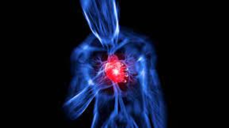 Infarto agudo de miocardio en la ciudad de Azul