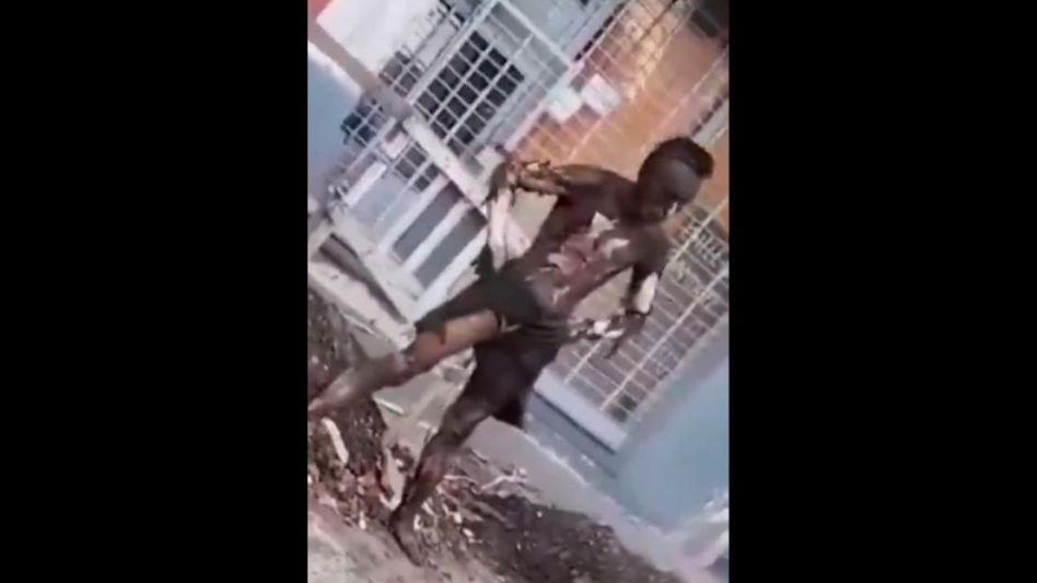 Intentó robar cables de luz y recibió una descarga: quedó con el 90% del cuerpo quemado