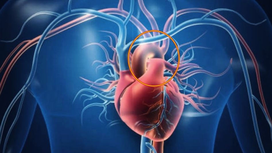 Reconocen a la arteria aorta como un órgano del cuerpo humano