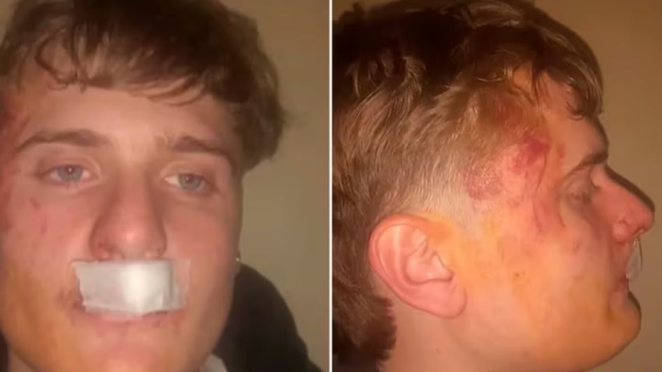 Brutal ataque de rugbiers a un joven en una fiesta de Zárate