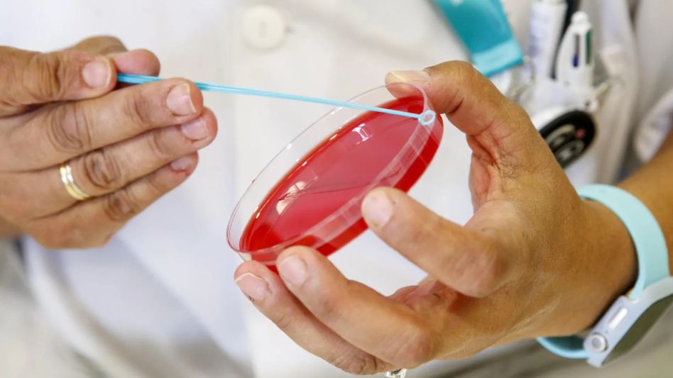 Advierten por un crecimiento de la sífilis con cifras récord en 2023 y tendencias que siguen en alza
