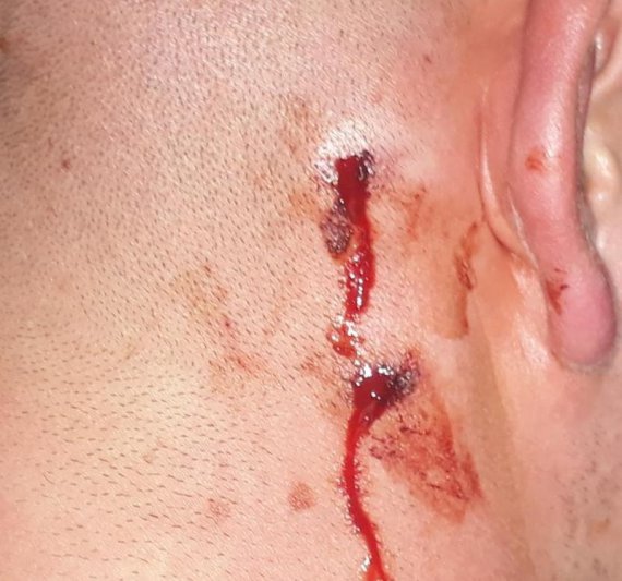 Denunciaron un caso de abuso policial