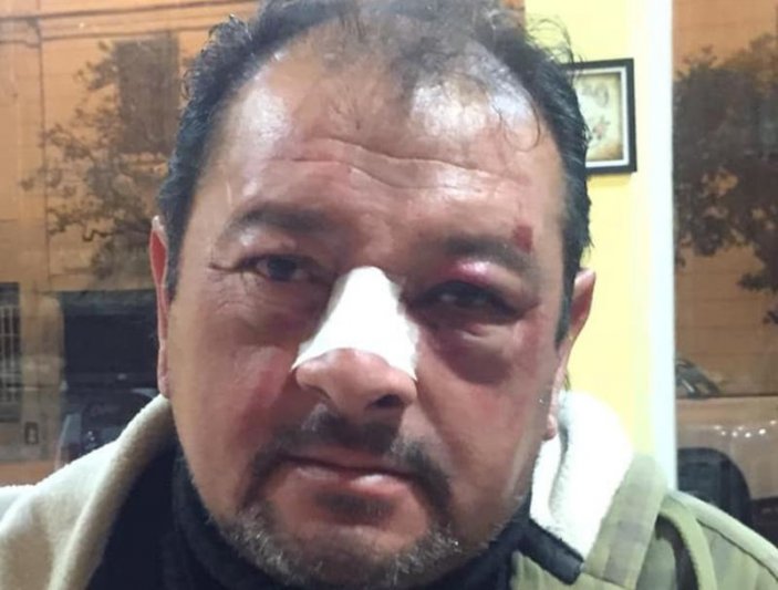 Brutal agresión a un remisero 