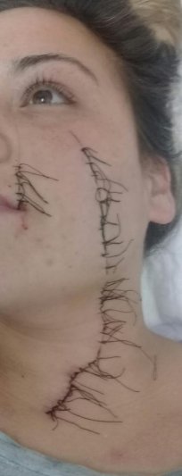 Desfiguraron el rostro de una joven  que fue víctima de un brutal ataque