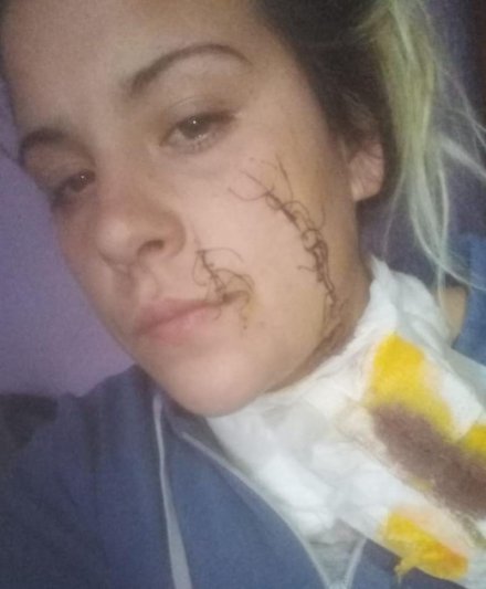 Acusadas de desfigurarle el rostro a una joven, ahora están detenidas