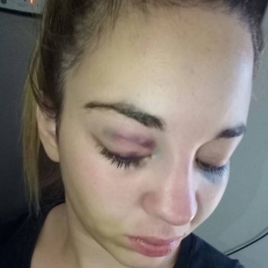 "Todos me escucharon gritar  pero nadie salió a ayudarme"
