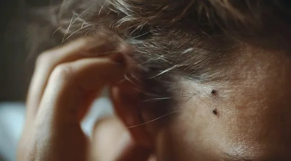#AlianzaMelaNOmás: los peluqueros se suman a la campaña para concientizar sobre el melanoma