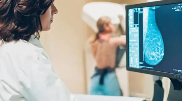Cáncer de mama: en Argentina se registran más de 20 mil nuevos casos al año